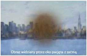 Zdjecie - /media/1016/zacma_1.jpg