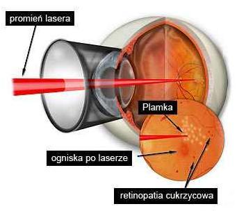 Zdjecie - /media/1048/laser_1.jpg